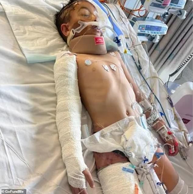 Huseyin, 8, was pinned between the bull bar of the Toyota Prado and the rear of a second car, suffering injuries to his pelvis, leg and femoral artery.  He remains in a serious condition at the Royal Children's Hospital (pictured)