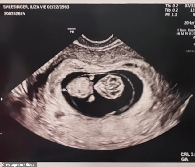 The comedian also shared a photo of their ultrasound and said they were so excited to meet him