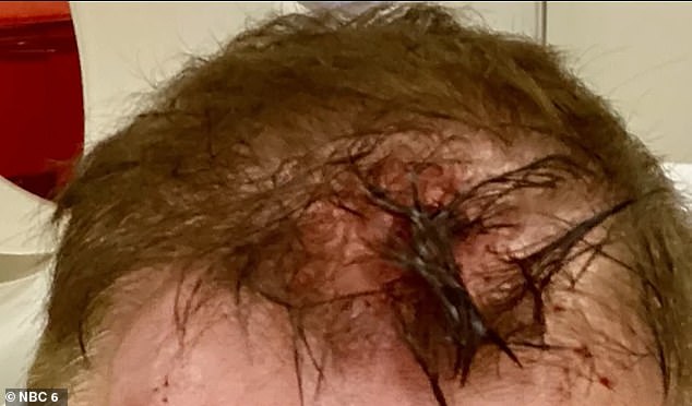 Thorton was seen with a bloodied and battered forehead and his hair soaked in blood