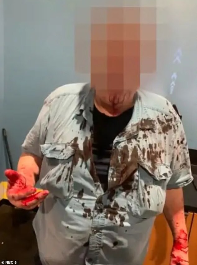 He was also left with his shirt and hands covered in blood