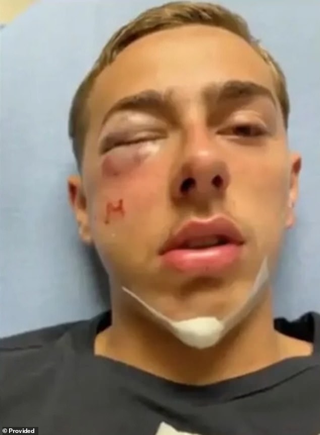The 15-year-old, identified only as Jadyn, was reportedly punched twice in the face by Walters, leaving him with a broken eye socket and a concussion.