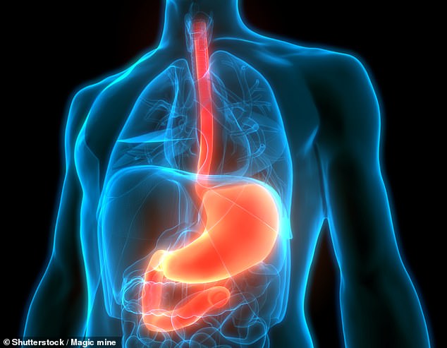 With more and more people developing reflux due to obesity and lack of exercise, and concerns about the health risks of long-term use of over-the-counter proton pump inhibitors (PPIs) to treat it, there is likely to be increasing clamor for such surgery