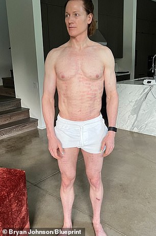 Bryan Johnson, 46, had made headlines for his all-out quest to live forever, which included swapping blood with his father and teenage son, guzzling 80 vitamins and minerals a day and eating 30 pounds of pureed vegetables a month.  He also wears a device on his penis every night that measures erections