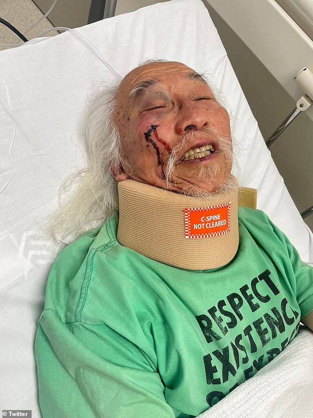 He was hospitalized in November after suffering head injuries during a shocking arrest