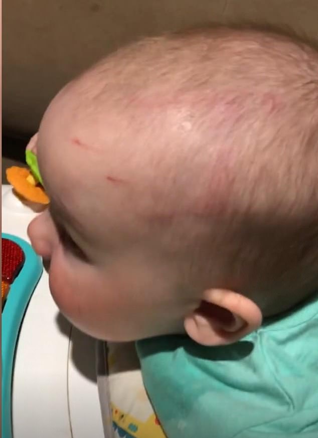 Seven-month-old Jack Swindells (pictured) was covered in scratches and bite marks after being attacked by an older child at his nursery while left unattended