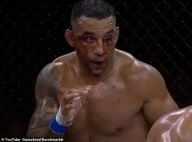 Fabricio Werdum's eye was seriously damaged on Friday evening during a bare-knuckle fight