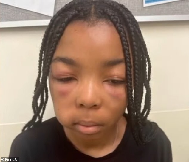 Kassidy Jones, 13, was attacked at a McDonald's in the Los Angeles area on September 6