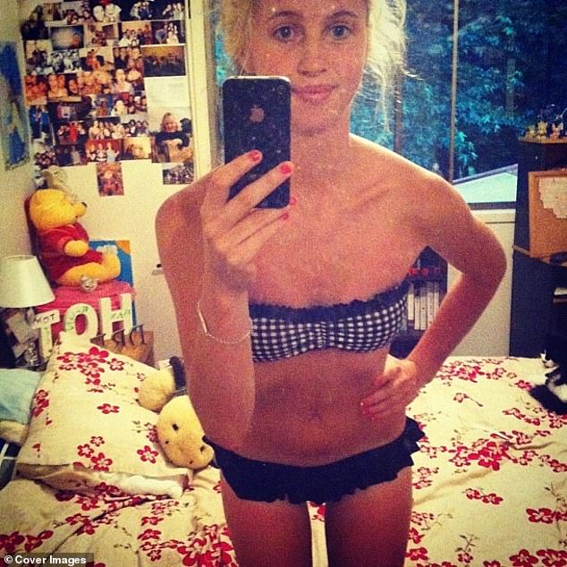 Monique Castaldi-Vesper (pictured before her 16th birthday), from Queensland, is one of an estimated million people in Australia currently suffering from an eating disorder