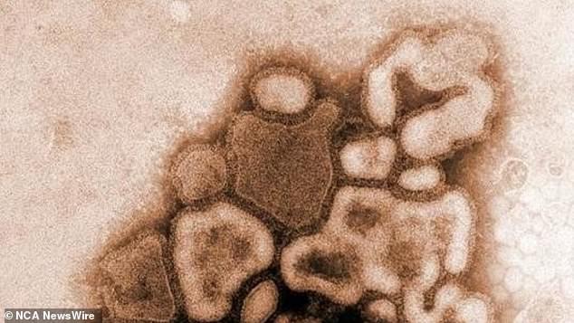 Microscope image of the H1N1 flu virus