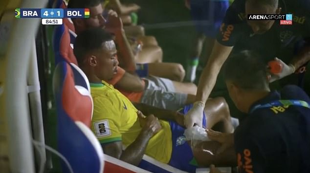 The defender was seen with an ice pack on his thigh after coming on as a substitute against Bolivia