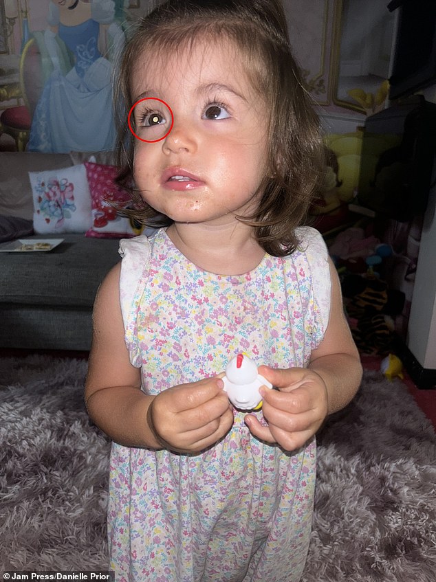 Evie Prior was just eleven months old when she was diagnosed with a rare form of cancer that took up three-quarters of her eye