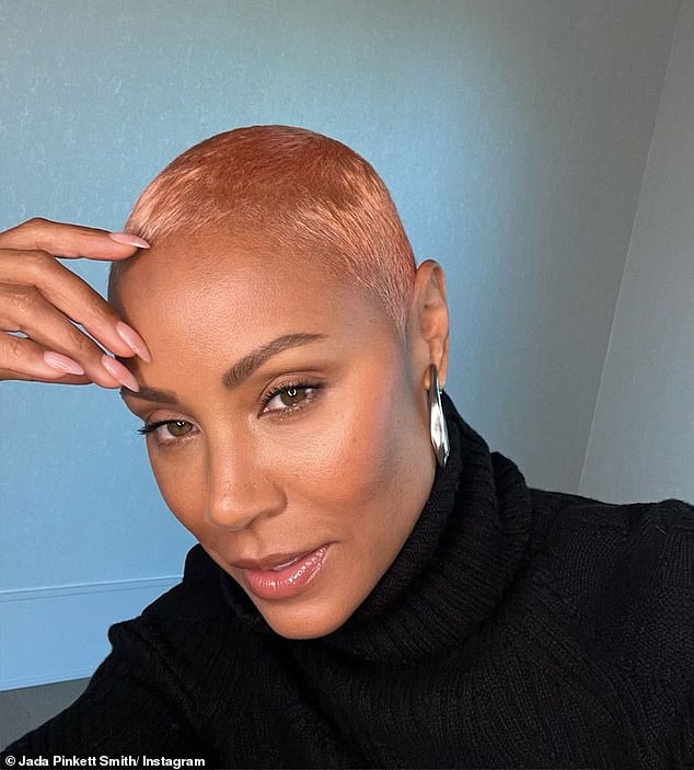 Jada Pinkett Smith, pictured, suffers from Alopecia areata, a common hair loss disease that affects 100,000 Britons