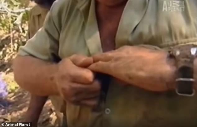 A resurfaced video of Steve Irwin (pictured) dealing with a broken finger has fans marveling at what a 