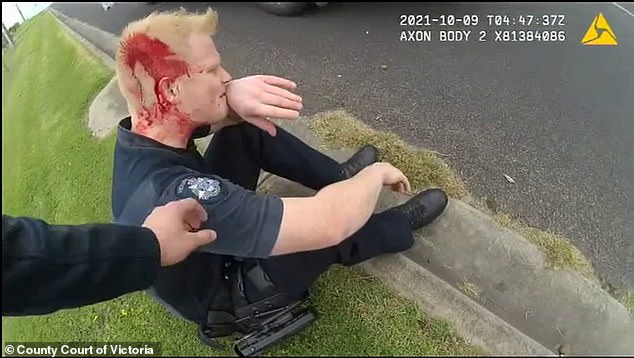 Senior Constable Rowan Baldam is pictured after the attack