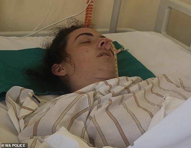 Harrowing new photos show Perth First Class Constable Ella Cutler, 25, incubated in a Croatian hospital bed after a devastating 11-metre fall in Dubrovnik on August 30