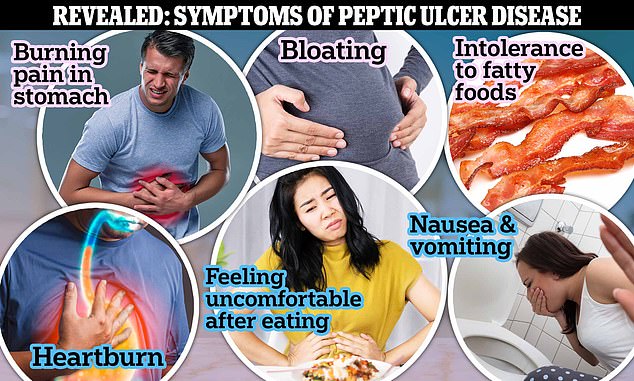 Pictured above are the symptoms of a stomach ulcer according to doctors