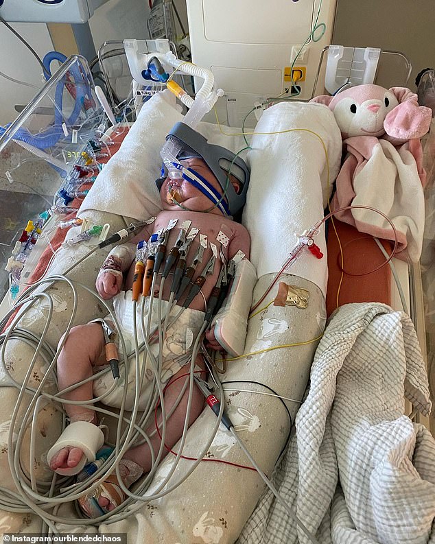 When Pixie's lungs began to collapse, the newborn was placed on a breathing tube and kept alive by machines as her heart failed.