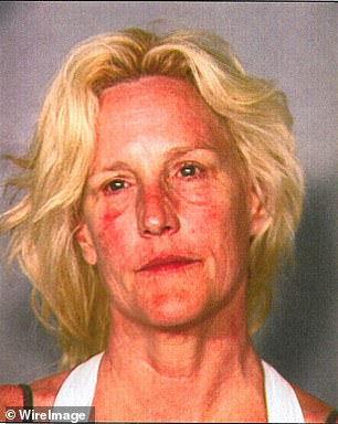 Erin's shocking mug shot made headlines around the world.  It showed her with severe sunburn and red spots near her eyes after her arrest for boating under the influence