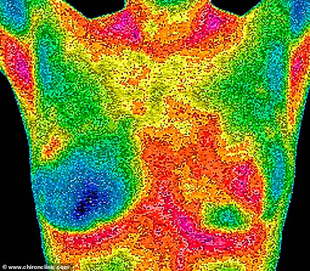 A breast scan using a technology called thermography, used at the Chiron clinic in Harley Street