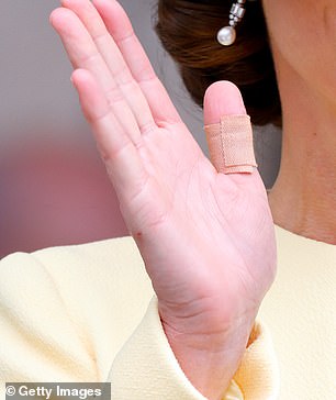 The princess also wore a plaster on her thumb as she attended the Thanksgiving service celebrating Queen Elizabeth II's Platinum Jubilee at St Paul's Cathedral on June 3, 2022 in London.