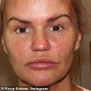 After!  It comes a week after Kerry showed off her firmer jawline following a 'non-invasive facelift'