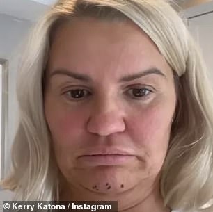 For!  The TV personality showed off the results of the procedure on Instagram and admitted she was 'blown away'