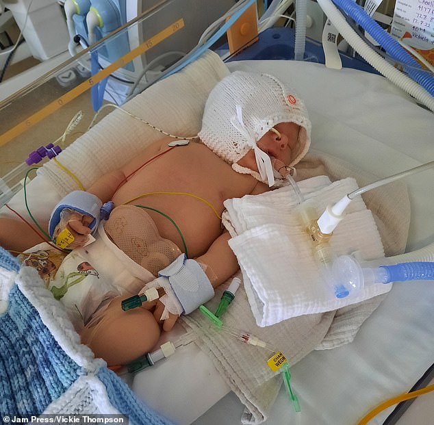 Charlie spent three days in the NICU after major surgery, two of which were in a coma.  It was only after seven days that Ms Thompson was able to take him home.  Pictured: Charlie after his operation