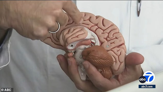 Robison demonstrates how he disconnected half of Briana's brain to stop her disease