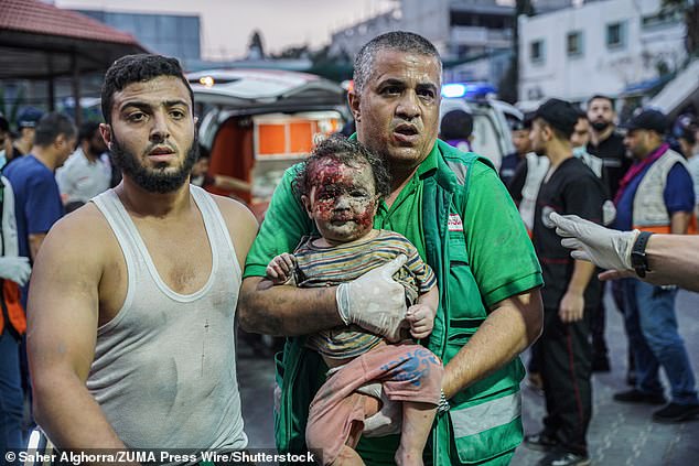 A paramedic holds a little girl with her face covered in blood and dirt from the effects of Israeli jets bombing Gaza, Palestine on Monday