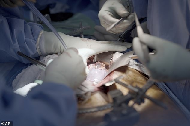 Surgeons removed the pig's kidney (pictured) on Wednesday and found it was still in good condition