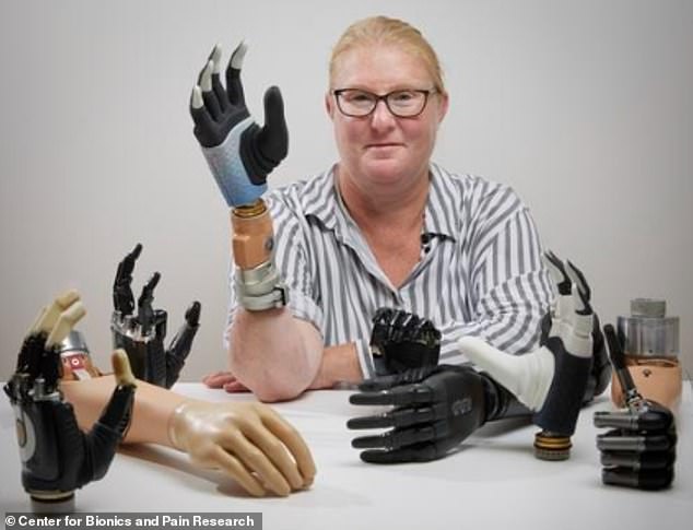 Before the operation, Karin (pictured) said she found traditional prostheses uncomfortable, unreliable and unhelpful in daily life.  She added: 