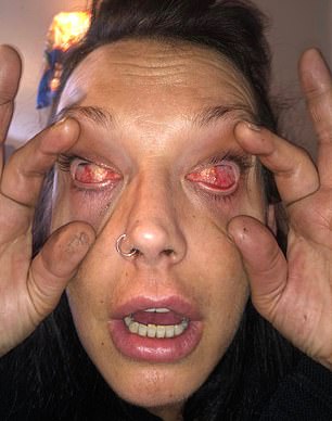In the photo: Toni Brown's eyes after the accident
