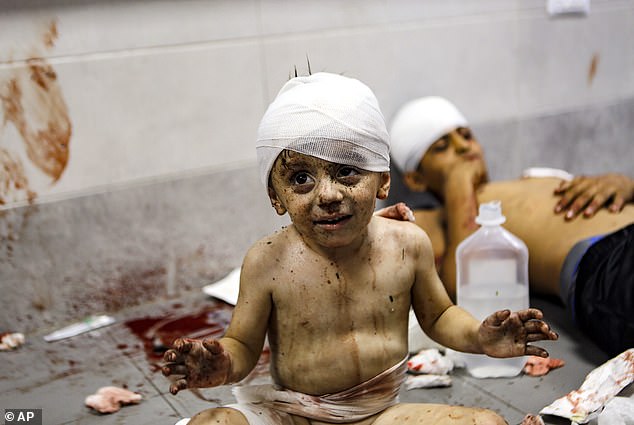 Wounded Palestinian children were in al-Shifa hospital in Gaza City on Tuesday after Israeli airstrikes