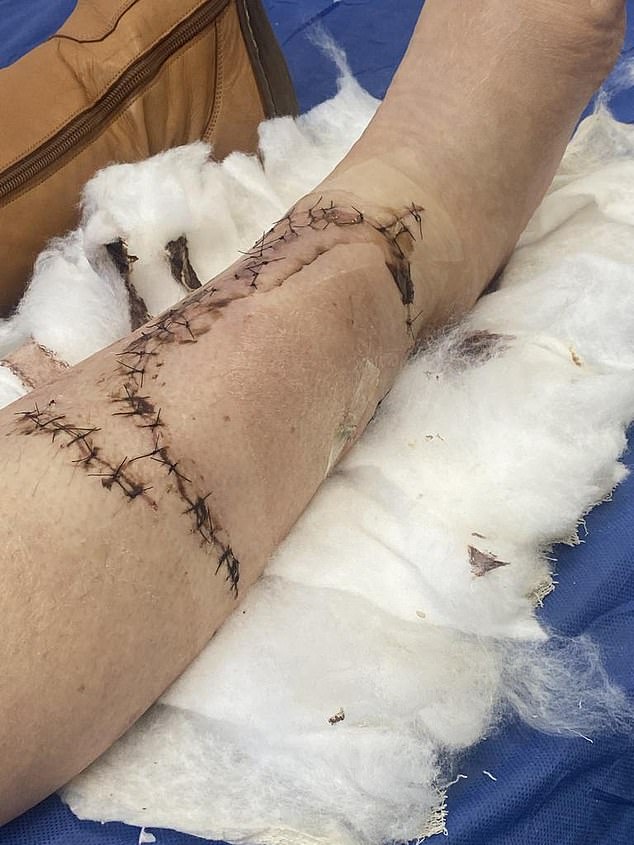 As she spent her morning swimming next to the Beachport jetty in South Australia, the shark first latched onto her lower leg before attacking her a second time.