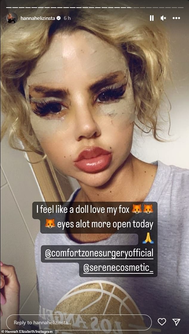 Under fire: Hannah recently slammed 'jealous and bitter' trolls for abusing her after her facial surgery transformation posts