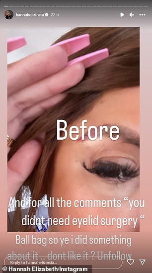 Job done: Another post showed a close-up of her eyelids before the procedure, writing: 'And for all the comments "you didn't need eyelid surgery", ball bag so I did something about it.. don't you like it?  Unfollow'