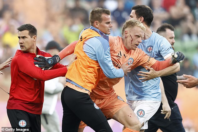 Melbourne City goalkeeper Tom Glover is escorted off the pitch with a bleeding head after being hit with a bucket during the 2022 Melbourne derby