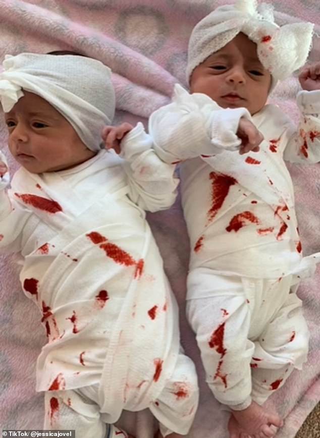 Jessica shared the photos of her then newborn twins in their mesh costume with blood on it, which people mistook for a tampon