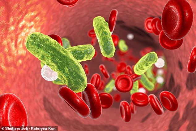 Sepsis, known as the 'silent killer', strikes when an infection such as blood poisoning triggers a violent immune response in which the body attacks its own organs