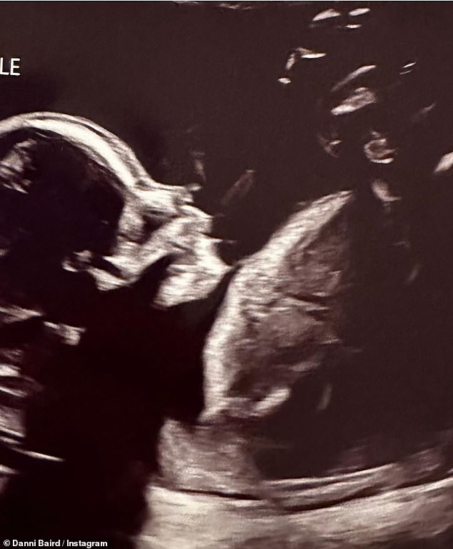 Bundle of Joy: Included in a carousel of images was a snapshot of her with a copy of her ultrasound scan