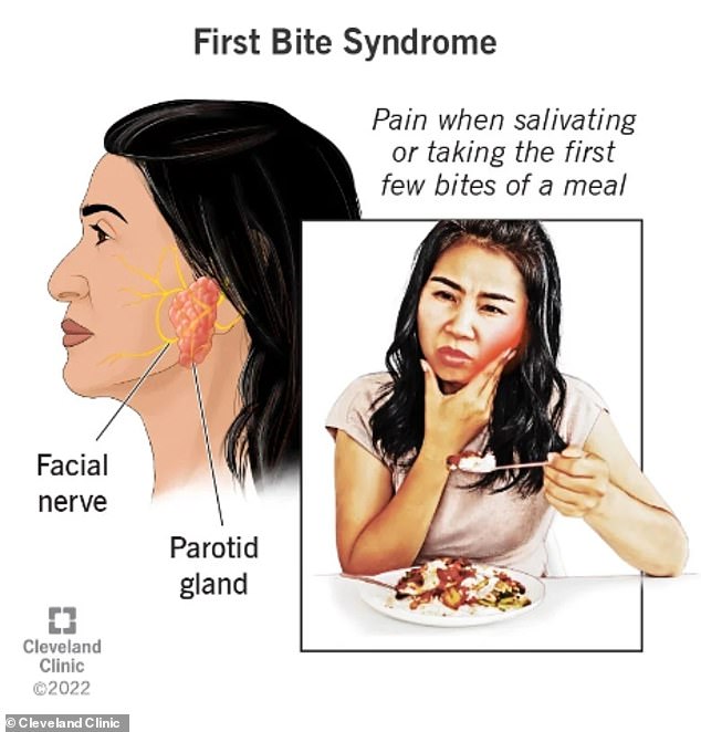 First Bite Syndrome causes severe cramps after the first bite of eating something.  The pain decreases with each bite