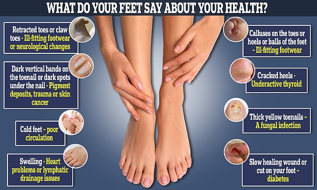 From annoying cracked heels to more serious symptoms like swelling, your feet often show symptoms of illness before any other part of your body