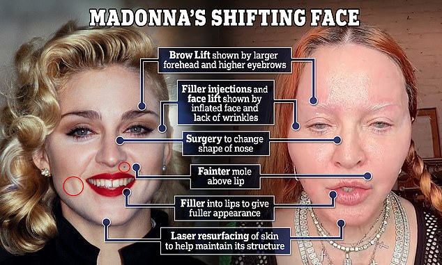 EXCLUSIVE Plastic surgeon charts Madonnas facial tweaks over the years