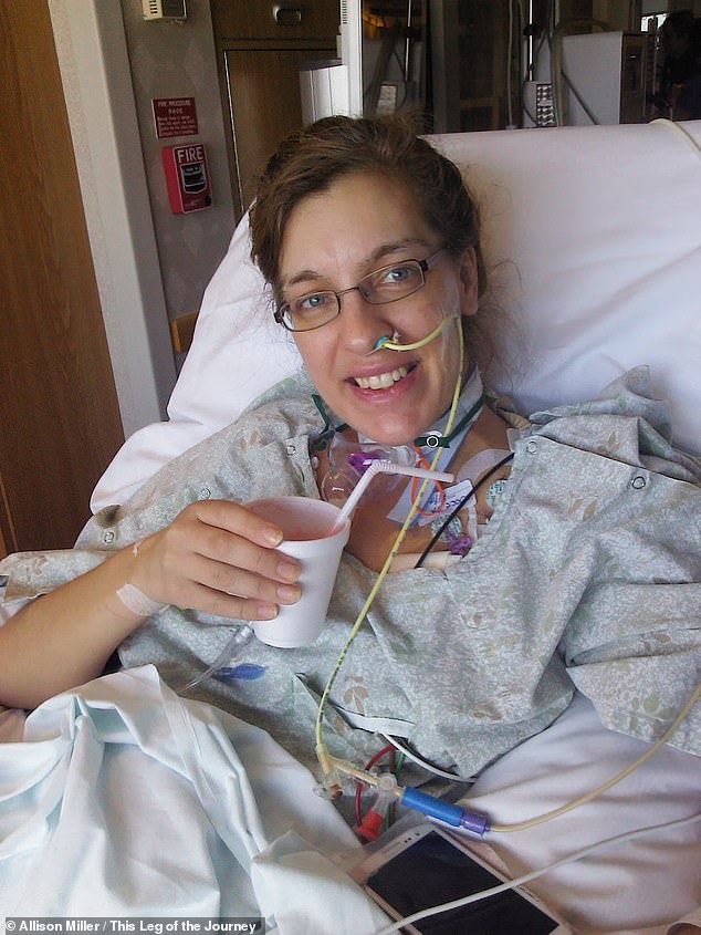 Allison Miller, 33, who lives in Virginia, spent three months in the hospital after her flu infection turned into sepsis.  She is pictured above