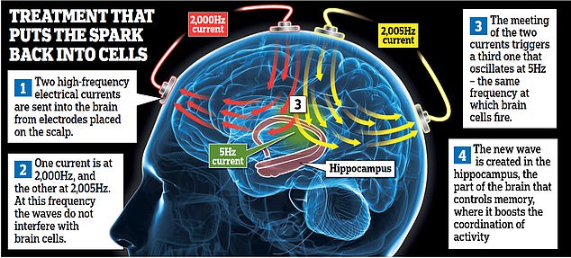 Hope in battle against Alzheimers as landmark trial reveals electrically