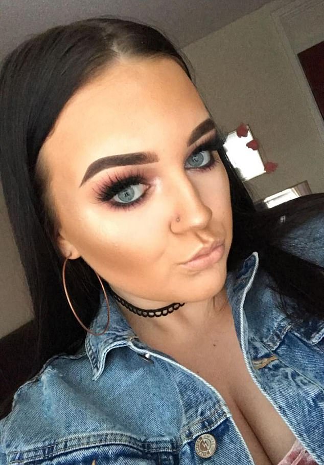 Botox treatments are banned for young people under the age of 18.  Catrina Banks (pictured) had filler injected into her lips at age 16, but her second procedure left her with facial swelling