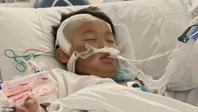 Jayden spent the next four days suffering from headaches and vomiting before his parents rushed him to Monash Medical Center where he underwent emergency surgery.