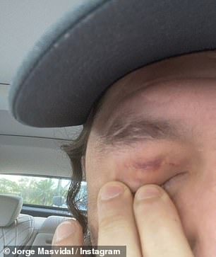 Masvidal posted an image of the damage caused by Colby Covington's eye poke during their fight at UFC 272