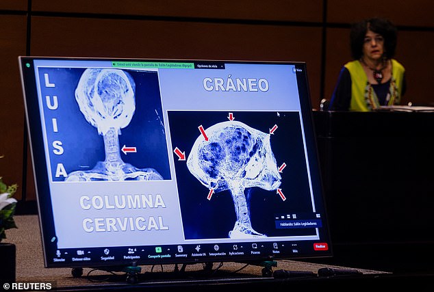 X-ray scans of the 'bodies' were presented on Tuesday, showing the insides of what many people have called fake.  Depicted is the 'skull' of one body