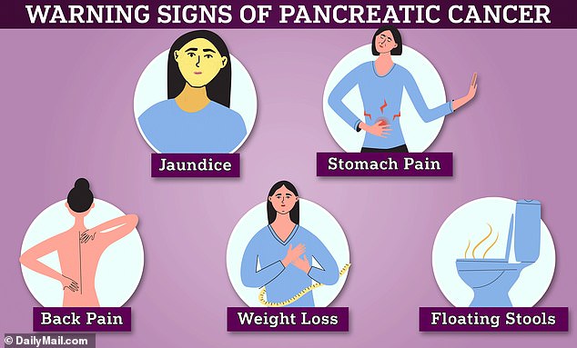 Early signs of pancreatic cancer include jaundice, stomach pain, back pain, weight loss and floating stools